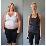 Before and After Weight Loss
