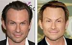Christian Slater Plastic Surgery Before and After
