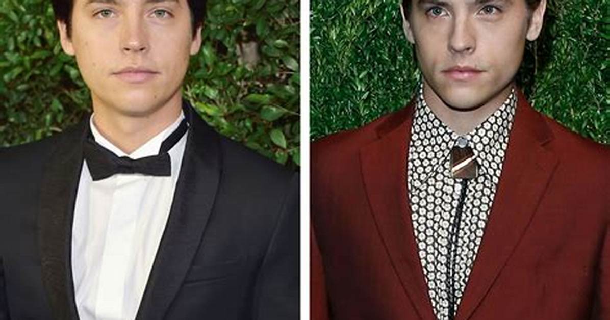 Cole Sprouse Teeth Before and After -Has He Used Braces and Whitened Them?
