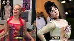 Did Billie Eilish Have Breast Reduction? Exploring the Truth Behind the Rumors