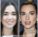 Did She Underwent Surgery? |