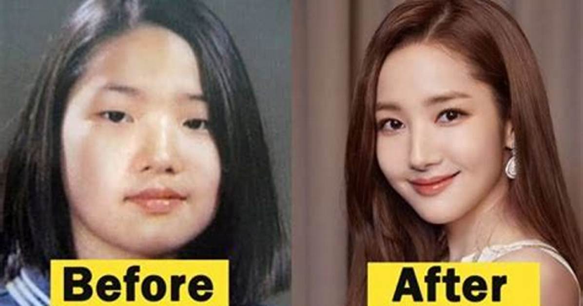 Did Yeonmi Park Had a Plastic Surgery? Is She Fake? Husband, Son and Instagram |