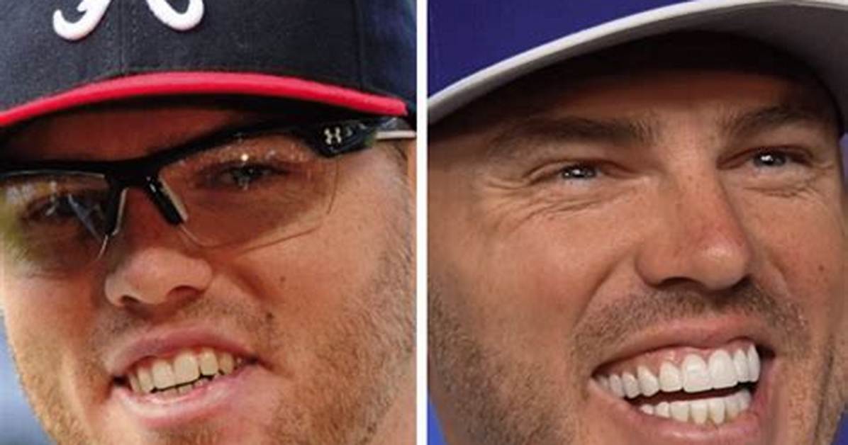 Does Freddie Freeman Have Veneers? Fake Teeth Rumors of the American Baseball Player