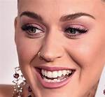 Katy Perry Bottom Teeth