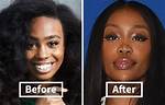 Sza's Strength and Resilience Before Surgery