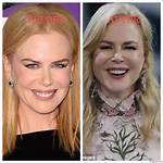 The Truth About Nicole Kidman's Transformation: Did She Get a Nose Job?