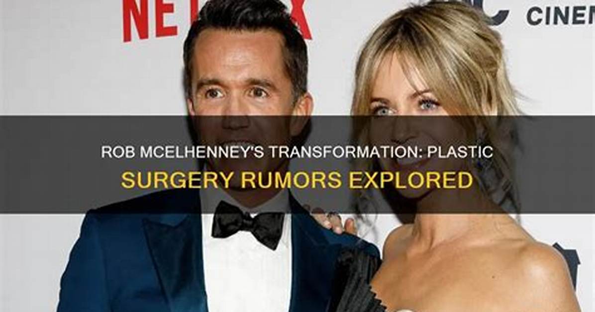 Unveiling Rob Mcelhenney's Plastic Surgery Journey: Before and After Transformation