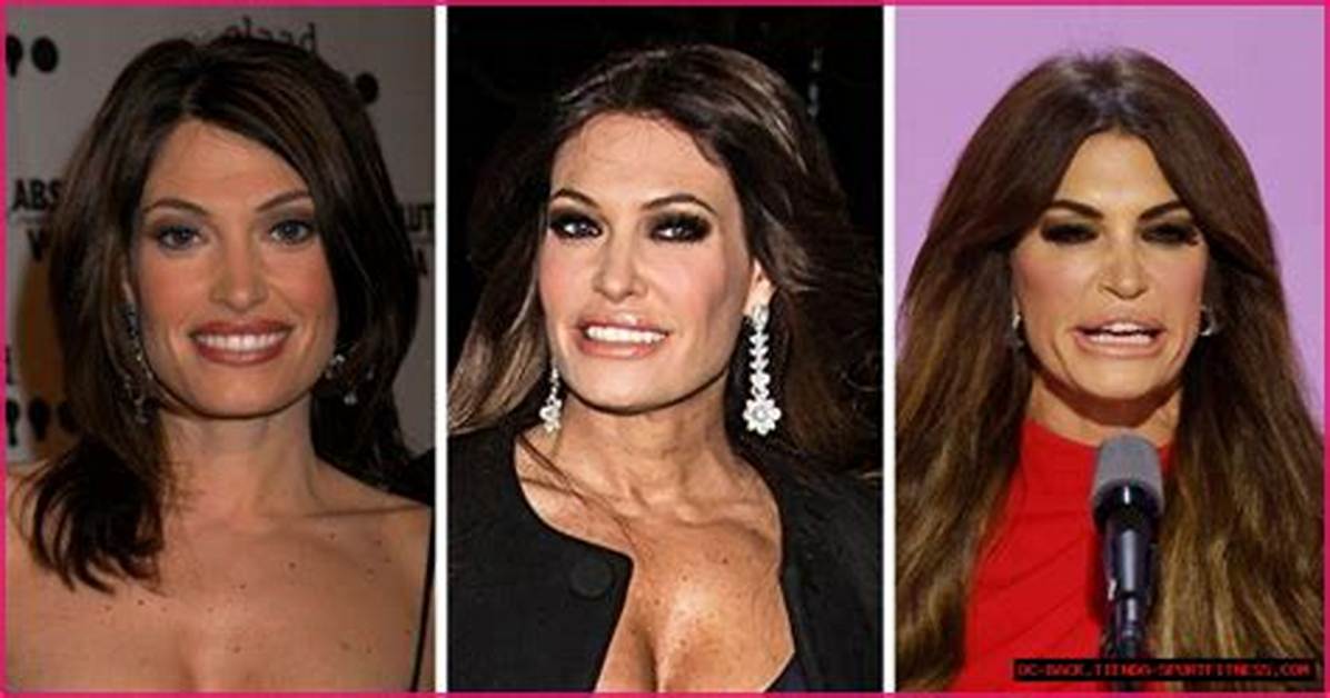 Unveiling the Secrets Behind Kimberly Guilfoyle's Face Transformation