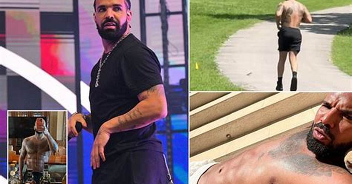 Unveiling the Truth Behind Drake's Bbl Scars